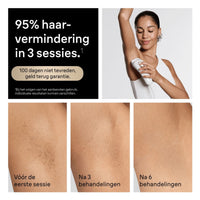 95 procent haarvermindering na 3 sessies met Braun IPL apparaat